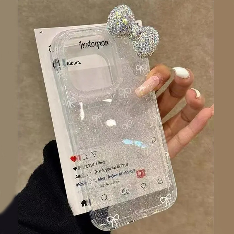 Luxury Watch Case - Luksusowe, błyszczące etui na telefon z